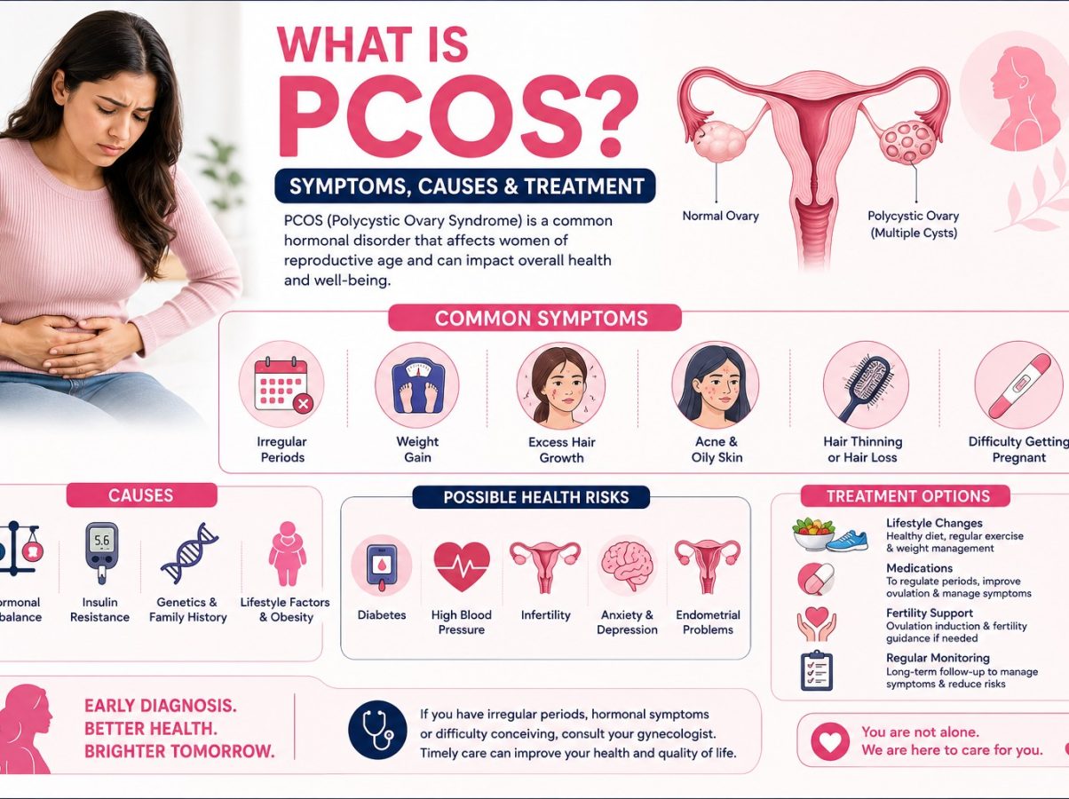 What is PCOS? Symptoms, Causes & Treatment
